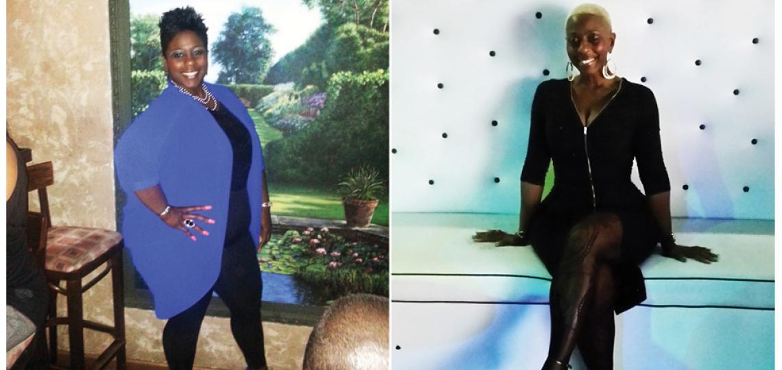 Before and after weight loss surgery
