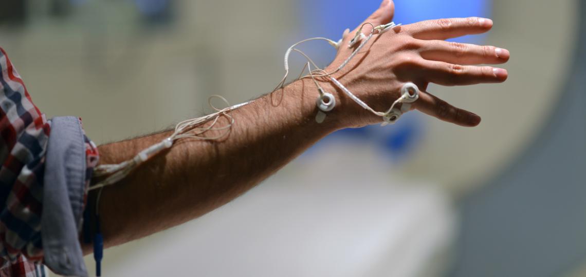 TMS Hand w/ Electrodes