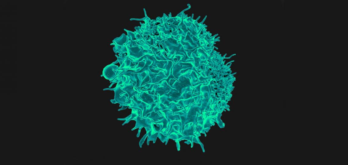 This is a colorized scanning electron micrograph of a T lymphocyte, a type of immune cell that can be 'trained' to fight cancer.